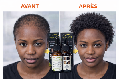 Huile Capillaire Disaar Anti-Chute – Aide à Densifier les Cheveux et Stimuler le Cuir Chevelu