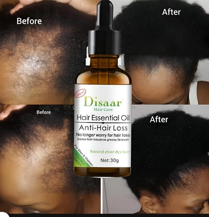 Huile Capillaire Disaar Anti-Chute – Aide à Densifier les Cheveux et Stimuler le Cuir Chevelu