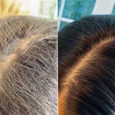 DISAAR – LE SHAMPOING QUI FAIT DISPARAÎTRE LES CHEVEUX BLANCS 🌿✨